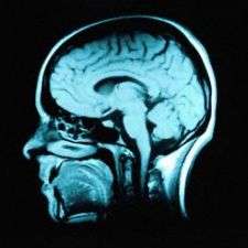 Discovery of neurotransmission gene may permit early detection of Alzheimer's disease 