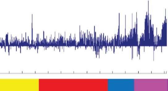 Study identifies a genetic driver of deadly prostate cancer