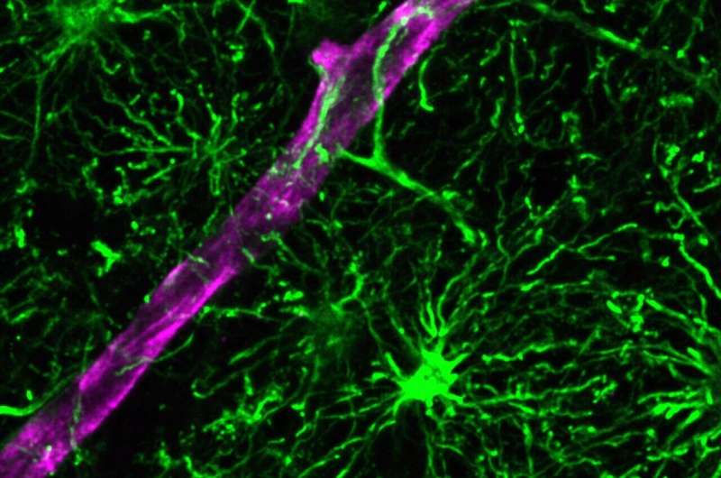 More than just neurons: Scientists create new model for studying human brain inflammation