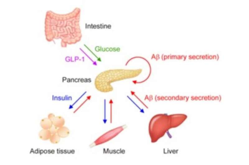 Effects of type 2 diabetes are major risk to development of Alzheimer's disease 