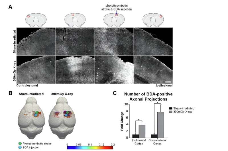 LDIR treatment induces axonal sprouting, brain rewiring and EEG oscillatory activity two months after ischemic stroke. (A) In X-ray-irradiated mice, a significant portion of axonal projections crossed the midline into the contralesional motor cortex. (B and C) Three-dimensional reconstruction of individual axonal projections revealed a significant number of neuronal projections in X-ray-irradiated mice two months after stroke. (D) EEG signals were recorded in both injured (red circle) and uninjured (yellow circle) cortices simultaneously in freely moving mice. (E) EEG activity was barely detectable in sham-irradiated mice two months after ischemic stroke. In contrast, brain activity markedly increased in X-ray-irradiated mice. Credit: Brain, Behavior, and Immunity (2023). DOI: 10.1016/j.bbi.2023.09.015