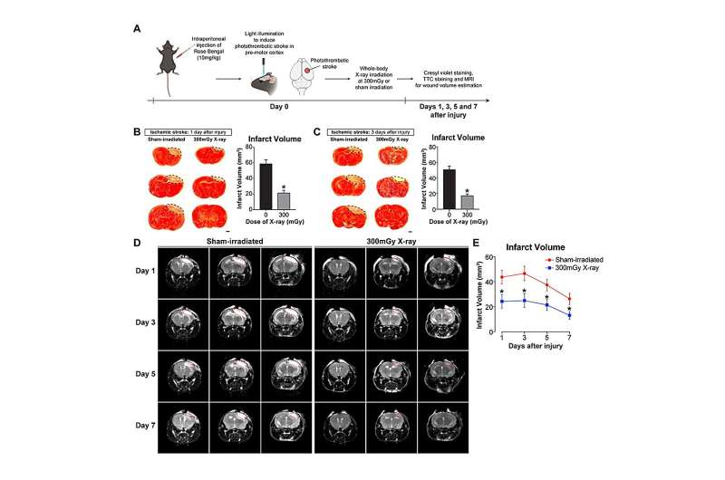 LDIR accelerates wound closure after ischemic stroke in adult mice. (A) Immediately after ischemic stroke induction, the mice received a single exposure to sham irradiation as control or LD X-ray irradiation at 300mGy. (B and C) The infarct volume (black dotted line) was markedly reduced in X-ray-irradiated (300 mGy) mice at 1 and 3 dpi. (D) Magnetic resonance imaging (MRI) to monitor brain infarction of the same animal during recovery. (E) MRI confirmed a significant reduction in mean infarct volume (red dotted line in D) in X-ray-irradiated mice. Credit: Brain, Behavior, and Immunity (2023). DOI: 10.1016/j.bbi.2023.09.015