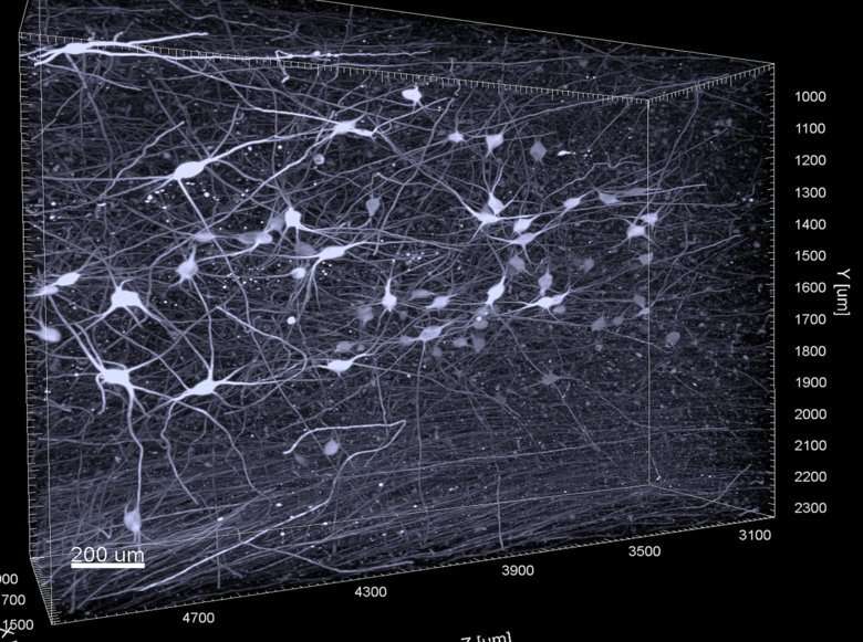 3D imaging helps to better understand the early stages of Alzheimer’s disease