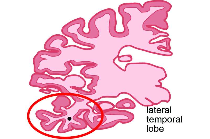 'Epigenetic landscape' is protective in normal aging, impaired in Alzheimer's disease 