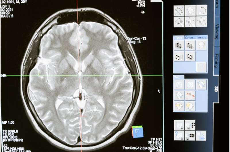 How frontotemporal dementia changes the brain: Research is untangling its genetic causes