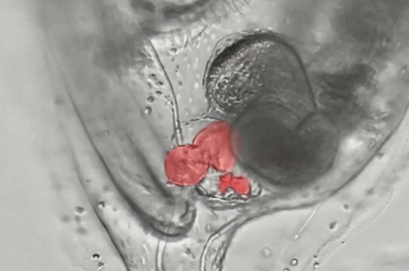 Extra fingers and hearts: pinpointing changes to our genetic instructions that disrupt development