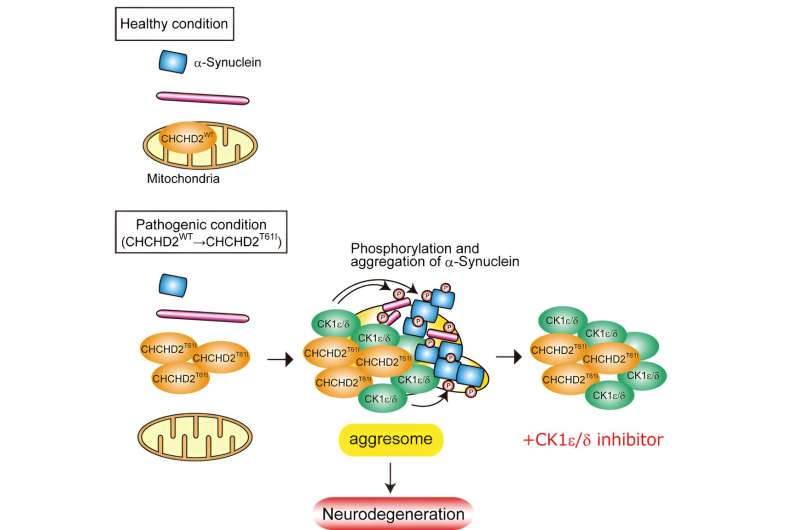 New insights into the development of Parkinson's disease in the brain