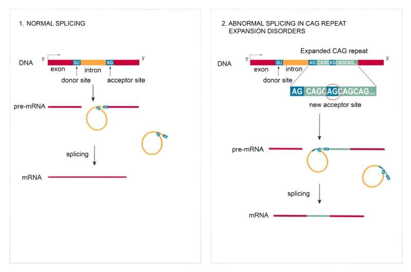 Protein production glitches in Huntington's disease revealed