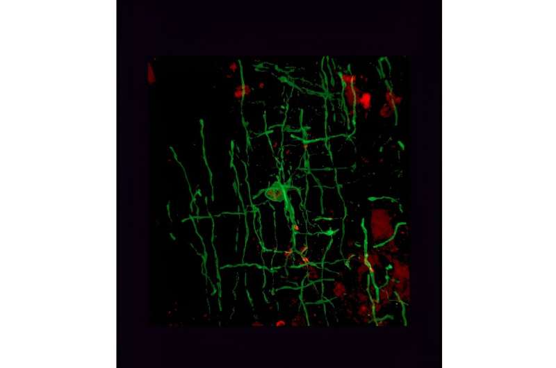 An oligodendrocyte, a type of cell responsible for myelin in the central nervous system, seen under a confocal microscope.