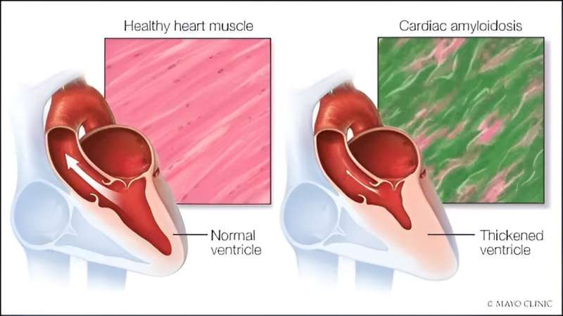 Credit: Mayo Clinic