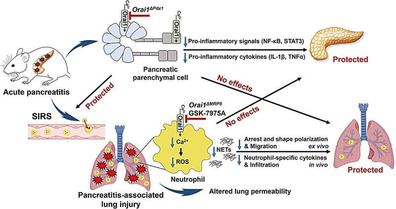 Altering key ion channel found to protect against pancreatitis-associated acute lung injury