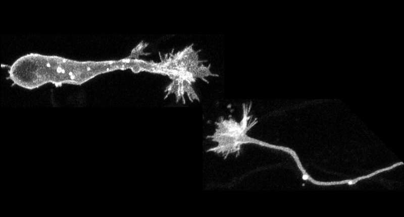 Growth cone in migrating neurons involved in promoting neuronal migration and regeneration in brain injury, study shows 