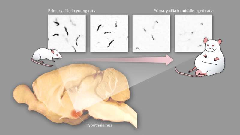 Middle-age obesity may be caused by changes in the shapes of neurons in the brain 