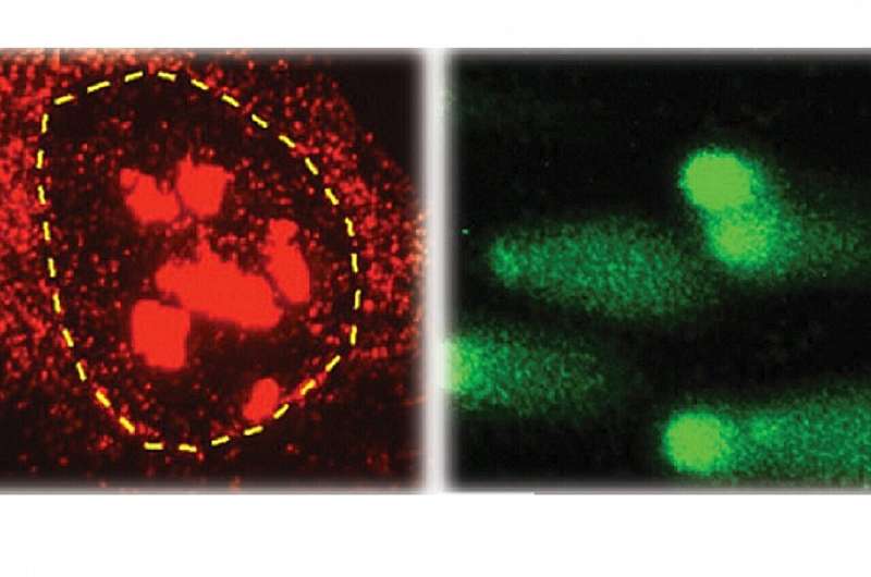 DNA protecting gene's crucial role in brain disorders revealed