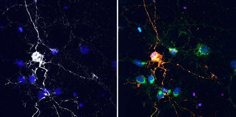 Neurons that express Lag3 proteins (grey/white) can take in Tau proteins (red) compared with neighboring neurons that do not express Lag3. Credit: Xiaobo Mao, Johns Hopkins Medicine