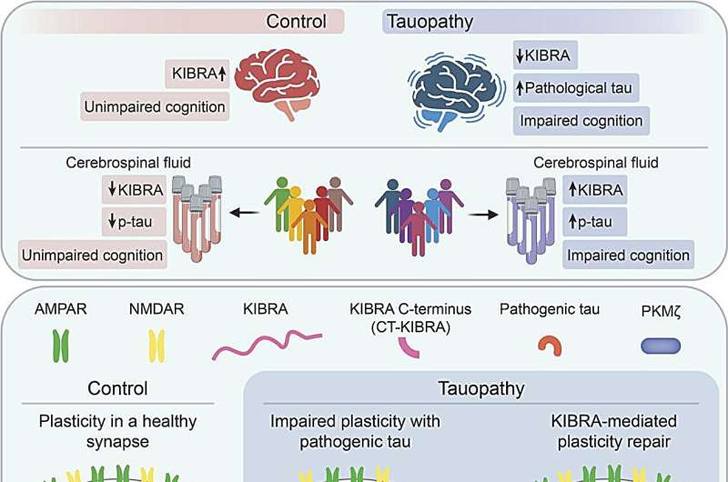 Graphical abstract. Credit: Journal of Clinical Investigation (2024). DOI: 10.1172/JCI169064. https://www.jci.org/articles/view/169064