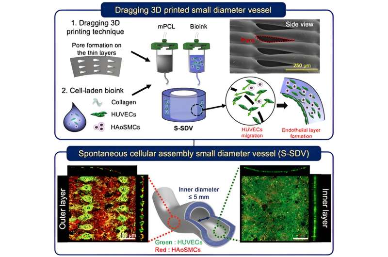 Fabrication process of S-SDVs and the results of HUVECs migration through pores. Credit: POSTECH