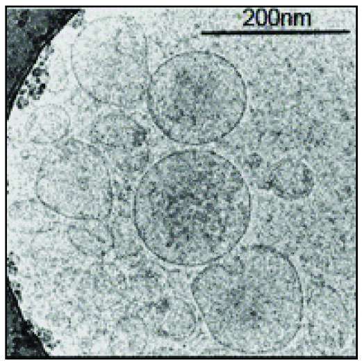 A novel immunotherapy proves effective in animal models of multiple sclerosis 