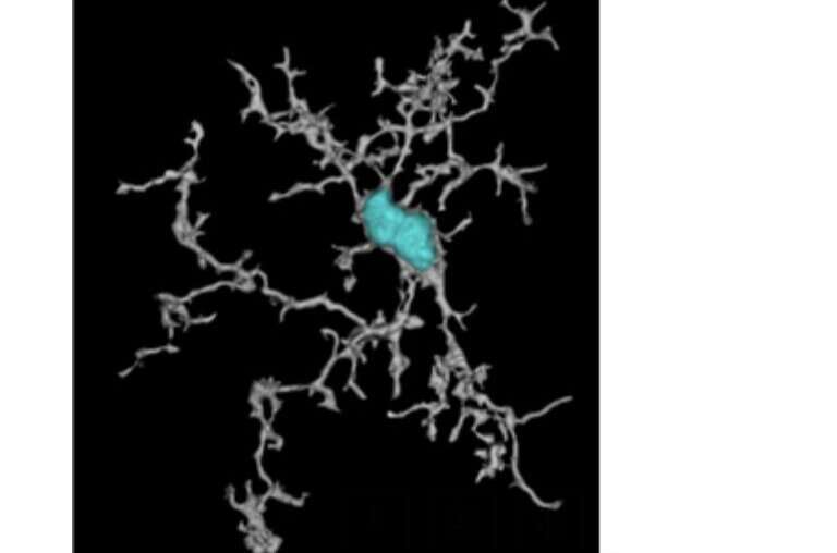 A TREM2 activating antibody with a transport vehicle that could boost the metabolism and function of brain microglia 