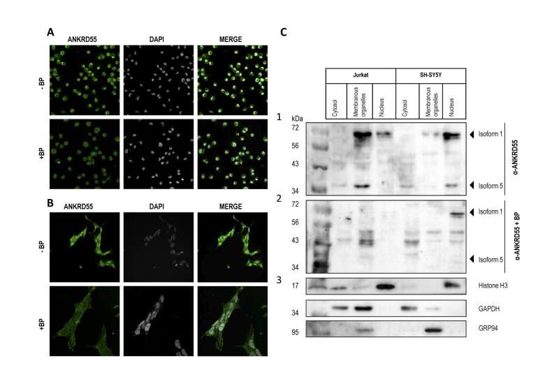 ANKRD55: A new gene involved in Multiple Sclerosis is discovered