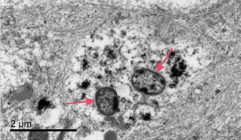 Cortexyme publishes data on P. gingivalis ability to infect neurons