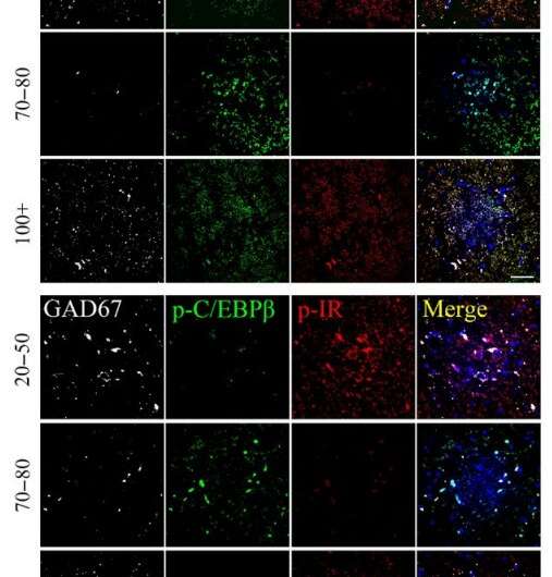 C/EBPβ/AEP pathway dictates both Alzheimer's disease and longevity: Study