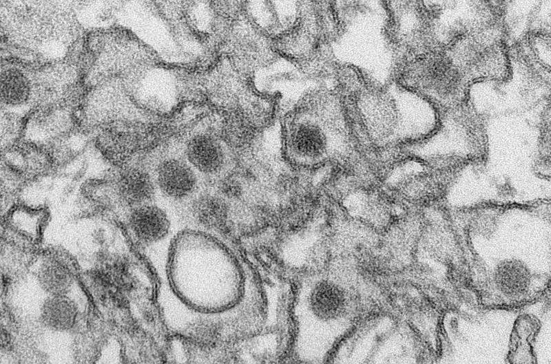 Researchers find Zika virus is effective when used to treat a type of childhood cancer in mice