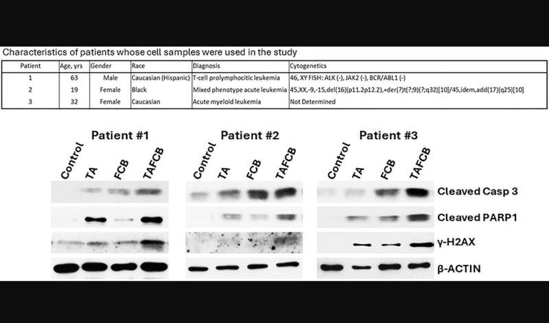 ABT199/Venetoclax synergism with thiotepa in acute myeloid leukemia (AML) cells