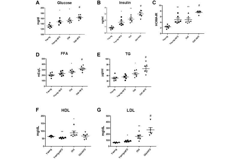 FoxO6-mediated ApoC3 upregulation promotes hepatic steatosis and hyperlipidemia in HFD aged rats: Study