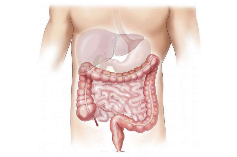 Antibiotics use in relation to colorectal cancer risk, survival and postoperative complications