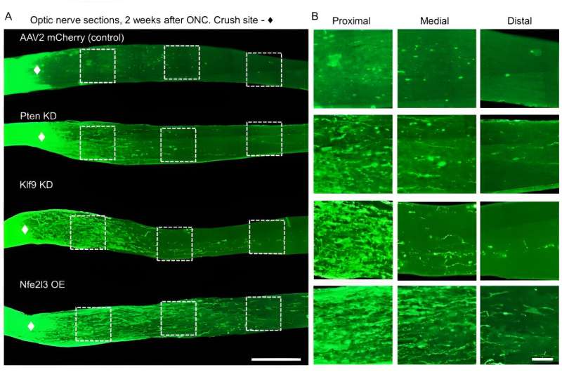 Researchers discover a protein that stimulates optic nerve regeneration