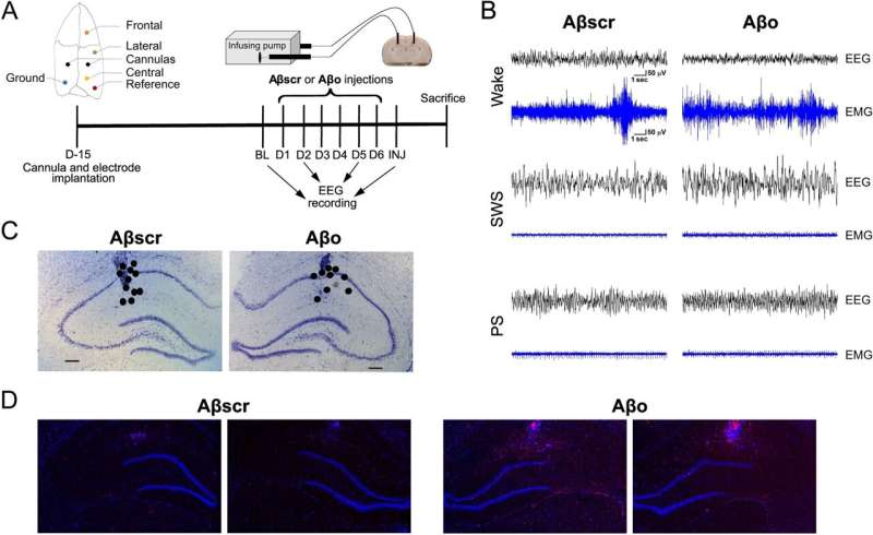 Decoding sleep to reveal our state of health