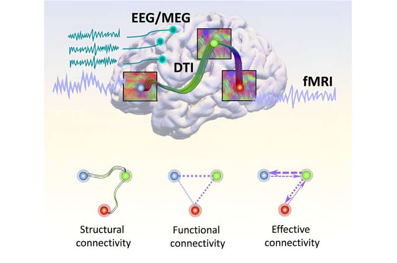 Unlocking Alzheimer's mysteries: A comprehensive brain connectome-based survey