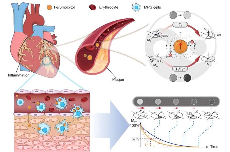 Exploring ferumoxytol: A new frontier in MRI contrast agents