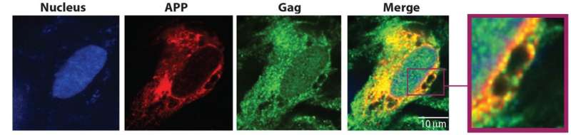 Molecular mechanism behind HIV-associated dementia revealed