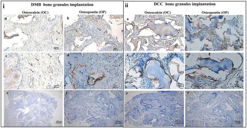 Scientists develop 'safe' bone grafts from cow bones to heal bone fractures and injuries