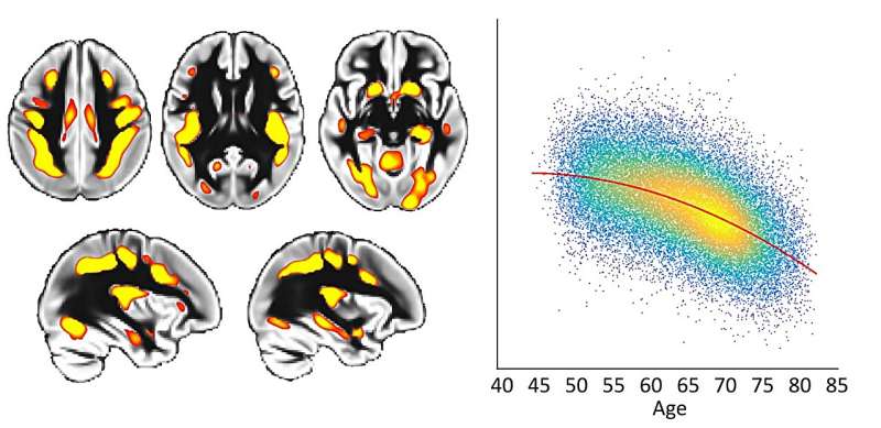 Risk factors for faster aging in the brain revealed in new study