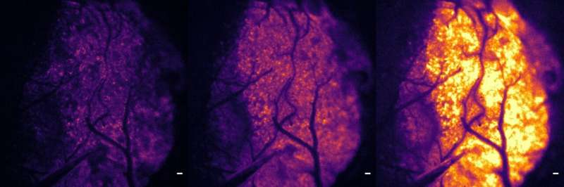 New imaging method illuminates oxygen's journey in the brain