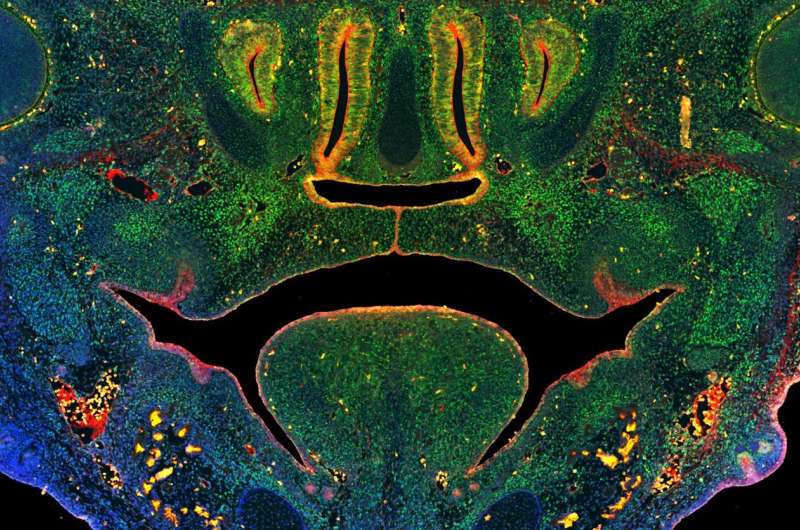 This image of a section through the midface of a mouse embryo illustrates fusion of the tissues that form the secondary palate above the tongue. Green staining illustrates cells expressing a key enzyme that mediates DNA methylation, blue indicates nuclei of all cells, red indicates epithelial cells. Credit: University of Wisconsin–Madison