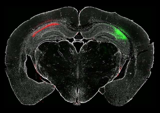 Study reveals a driver of brain cell damage in neurodegeneration 