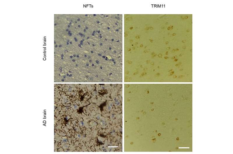 Tau-regulating protein identified as a promising target for developing Alzheimer's disease treatment 