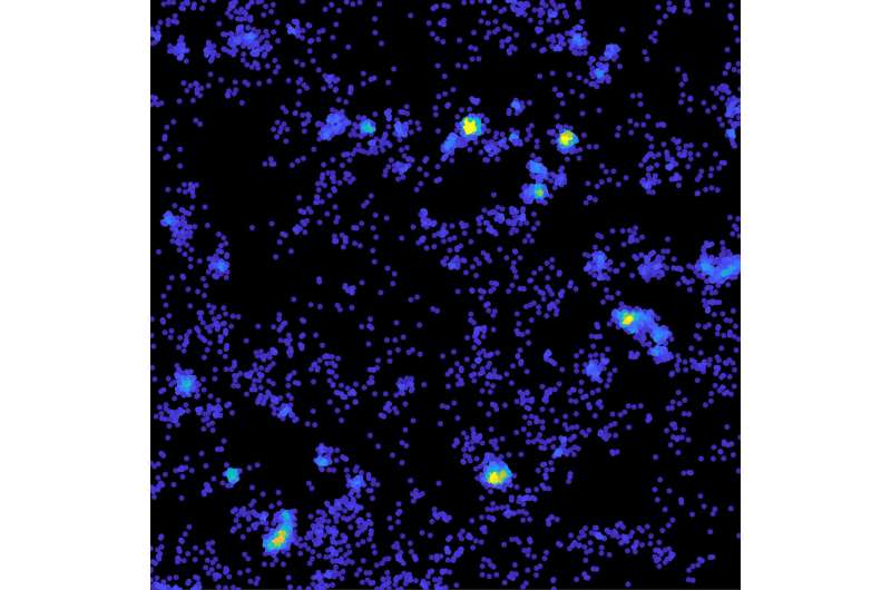 Tau hot spots open new avenues of discovery into dementia 