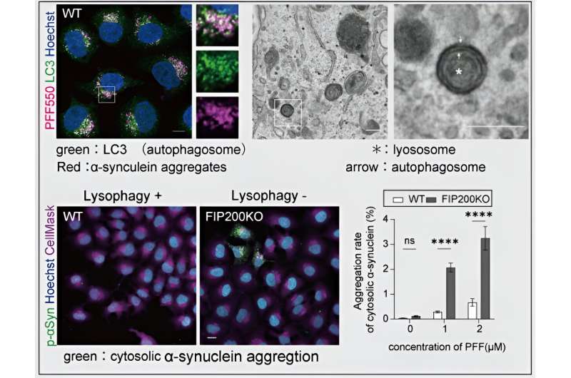 Researchers discover new links between cellular-waste removal and the development of Parkinson's