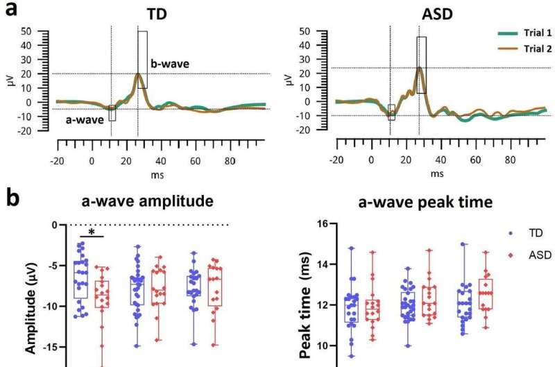 Chemical regulates light processing differently in the autistic and non-autistic eye, new study finds