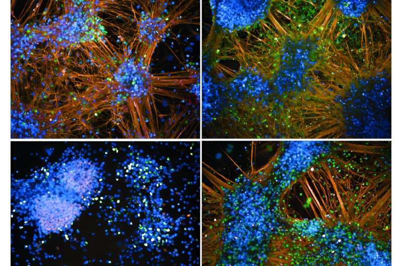 JAX researchers make mice a more powerful tool to study a wide range of human diseases