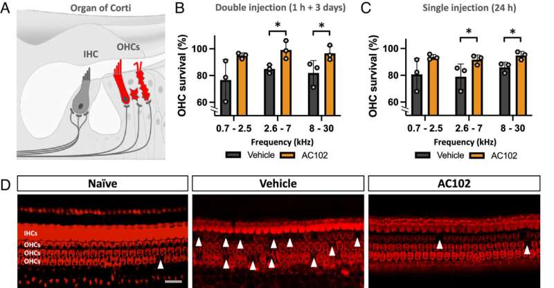 Novel compound AC102 restores hearing in preclinical models of sudden hearing loss