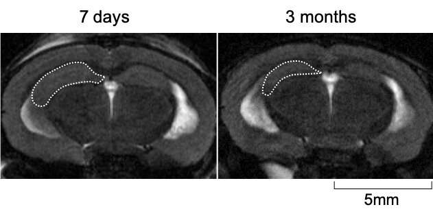 Alzheimer’s disease protein links plaques to cell death in mice