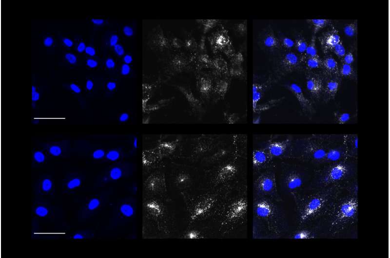 Alzheimer's risk gene disrupts endocytosis, but another disease-linked gene could help 