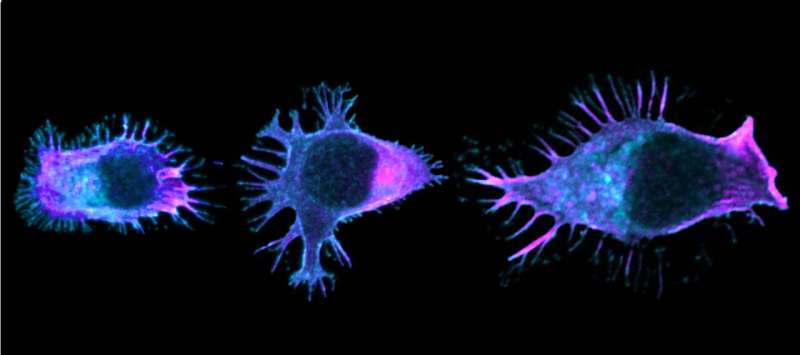 Colon cancer: How mutation of the APC gene disrupts lymphocyte migration