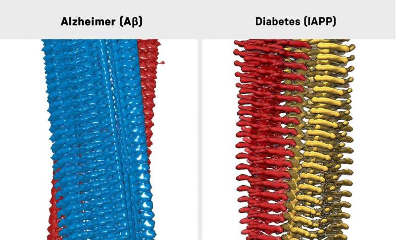 New indication of a link between Alzheimer's and diabetes